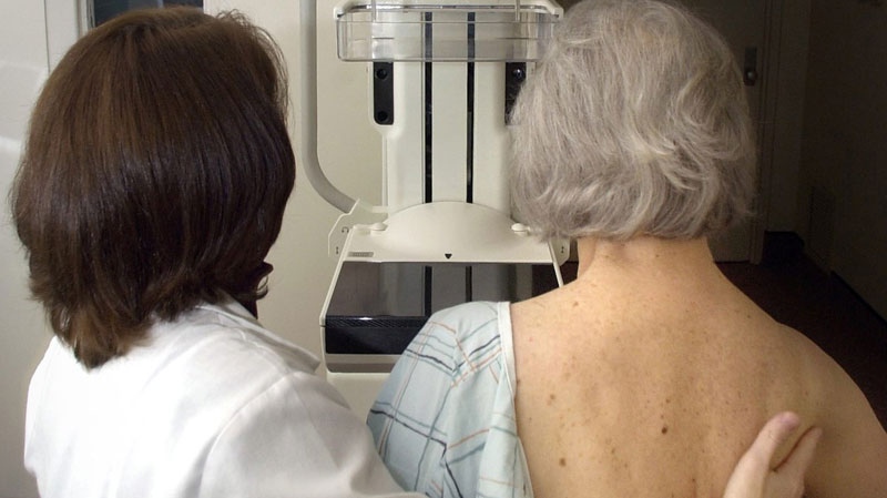 MSU Radiology Department Mammographer Jackie Riley, left, prepares Jean Lockwood for a digital mammogram in East Lansing, Mich., Monday, Oct. 22, 2001. (AP / Lansing State Journal, Becky Shink)