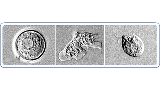 The Naegleria fowleri amoeba 