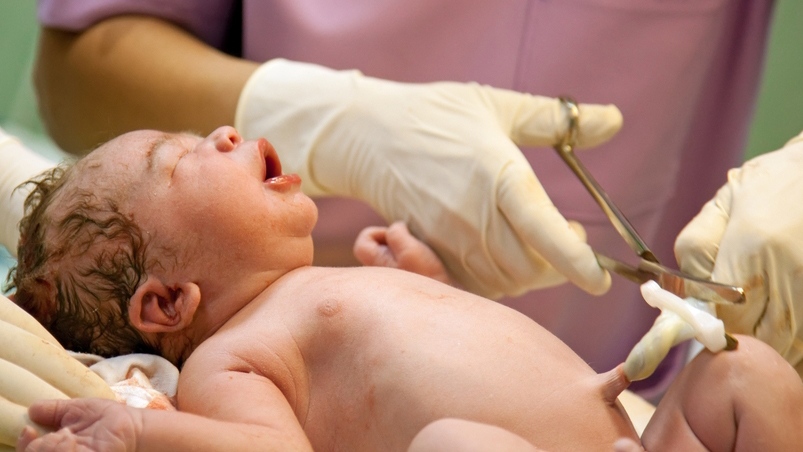 New recommendations suggest waiting up to 1 minute before cutting umbilical  cord