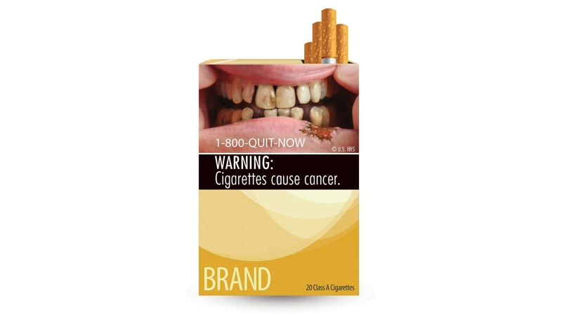This image provided by the U.S. Food and Drug Administration on Tuesday, June 21, 2011 shows one of nine new warning labels cigarette makers will have to use by the fall of 2012. (AP Photo/U.S. Food and Drug Administration)