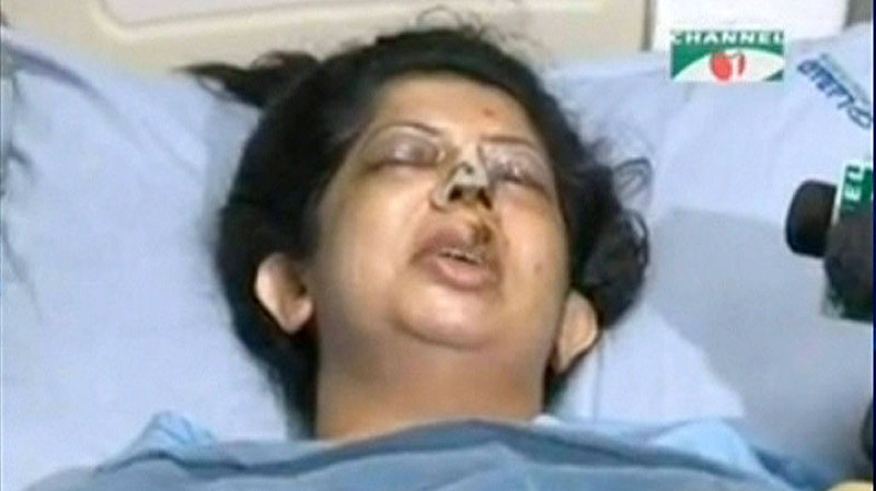 This image shows Rumana Manzur after she was victim of a brutal attack.