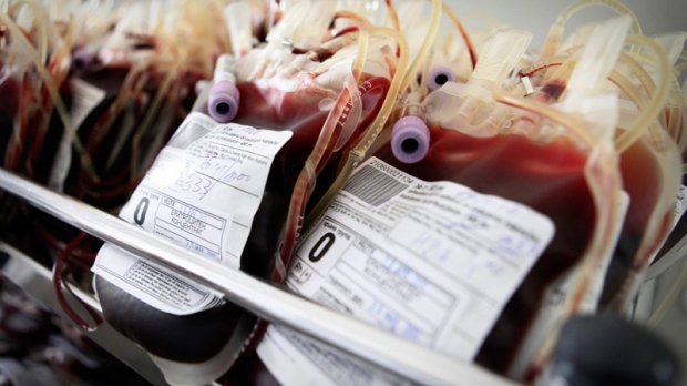 In this Tuesday April 26, 2011 photo blood units are prepared for storage at the National Center for Hematology and Transfusion in Sofia, Bulgaria. (AP Photo/Valentina Petrova)