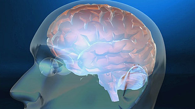 Brain Study, brain injuries, Hotchkiss Brain Insti