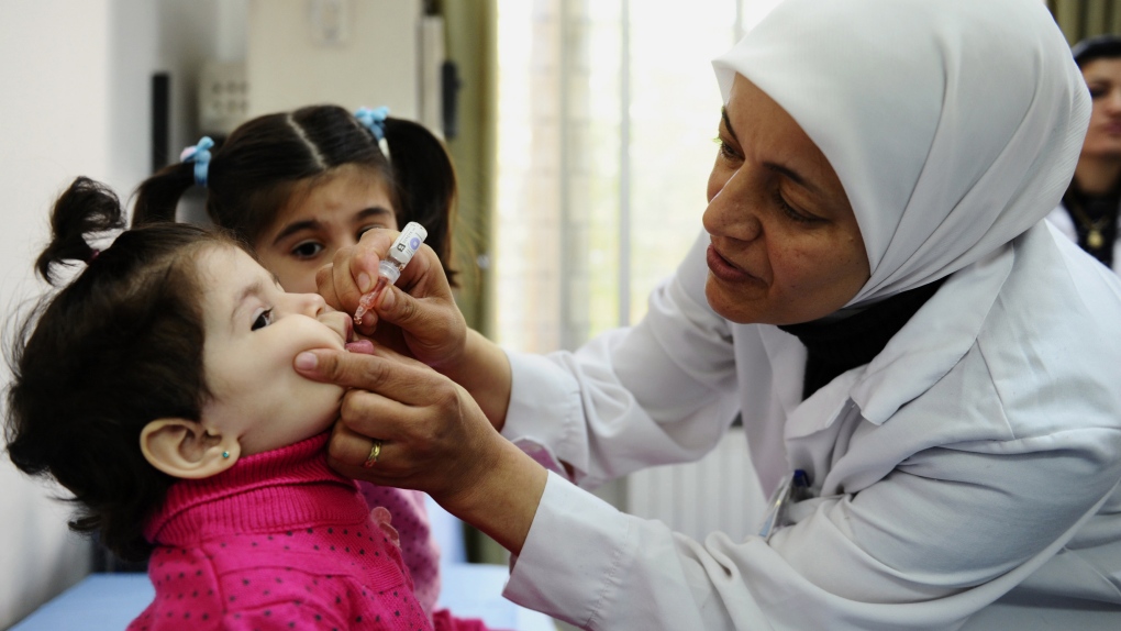 Polio outbreak in Syria