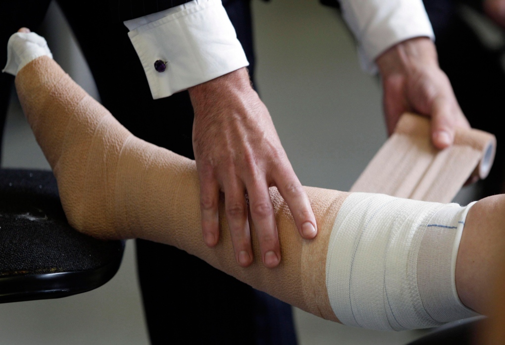 Compression bandages work as well for lymphedema