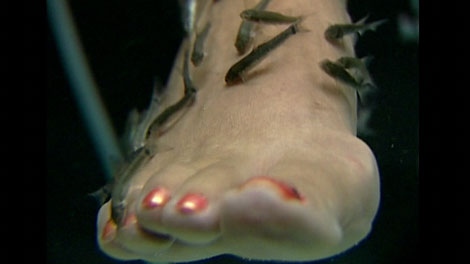 The "Dr. Fish" pedicure procedure is popular in Asia and Europe. July 14, 2011. (CTV)