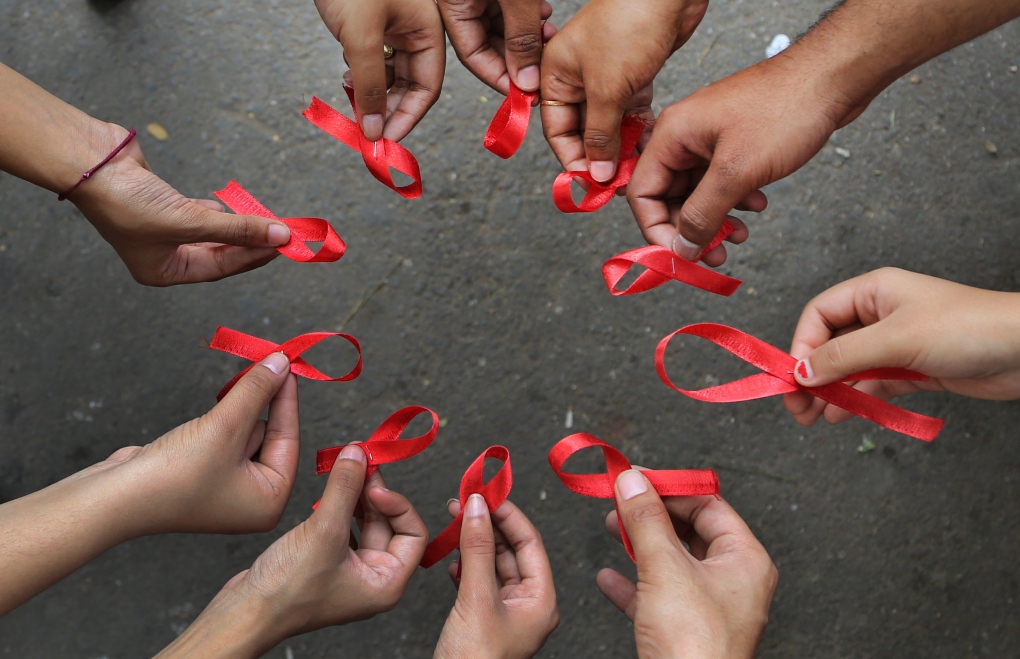 HIV/AIDS rates jump in Iran
