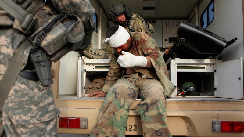 A wounded Afghan National Army soldier sits on an ambulance as U.S. Army flight medic CPL. Amanda Mosher from Cheyenne, Wyo. tries to tend him, following a roadside bomb attack on the outskirts of Kandahar, Afghanistan, Friday, July 29, 2011. (AP / Rafiq Maqbool)