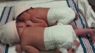 Twin sisters Gabriela and Sophia were born seconds apart but in different years in Mississauga. (Credit Valley Hospital)