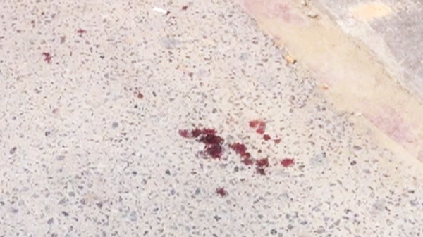Droplets of blood on the sidewalk after a falling-glass incident at Grenville and Bay Streets on Monday, Aug. 15, 2011.