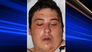 An unidentified man who was found injured in the 2400 block of Eighth Avenue in Regina on Saturday morning is seen in this photo provided by Regina police. 