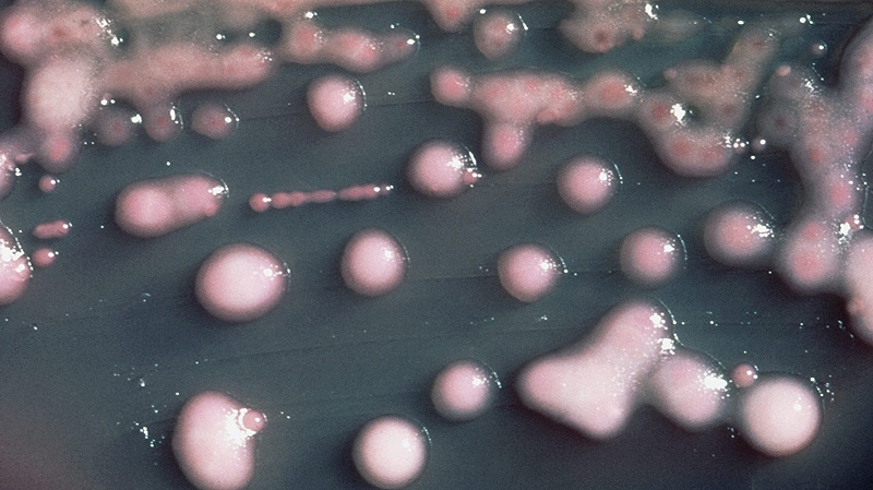 A Montreal hospital has been battling for the last year to extinguish an outbreak with a worrisome and highly drug-resistant bacteria. The bacteria (shown) is a strain of Klebsiella pneumoniae that carries a genetic component that makes it resistant to almost all antibiotics. The component, called KPC for short, can also transfer to other types of bacteria, making them highly drug resistant too. THE CANADIAN PRESS/HO- U.S. Centers for Disease Control