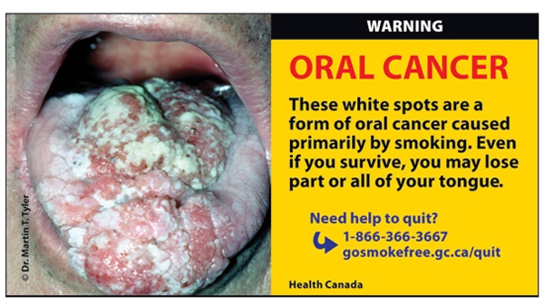New larger and more graphic warning labels will appear on cigarette labels by mid-June, 2012.