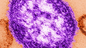 The measles virus is seen through an electron micrograph. (C. S. Goldsmith; William Bellini, Ph.D.)