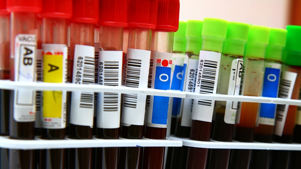Tool does blood tests via smartphones