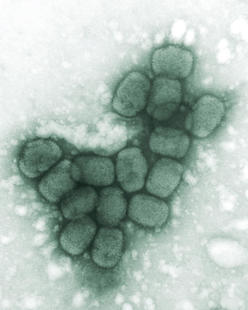 Electron micrograph of smallpox viruses