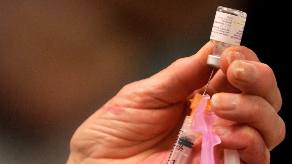 Combined MMRV vaccine shows increased seizure risk