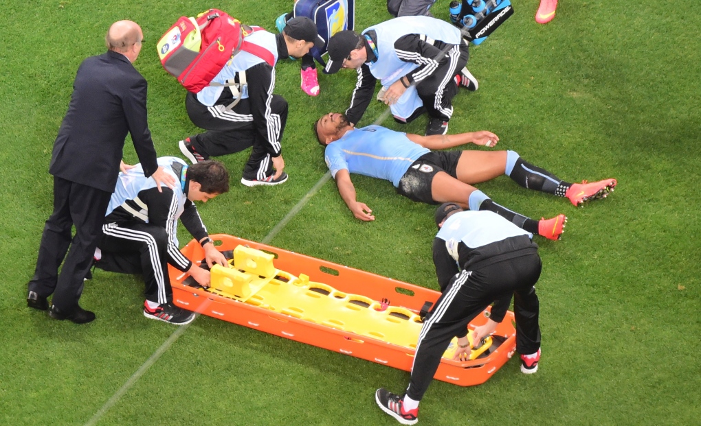 World Cup Uruguay's Alvaro Pereira concussion