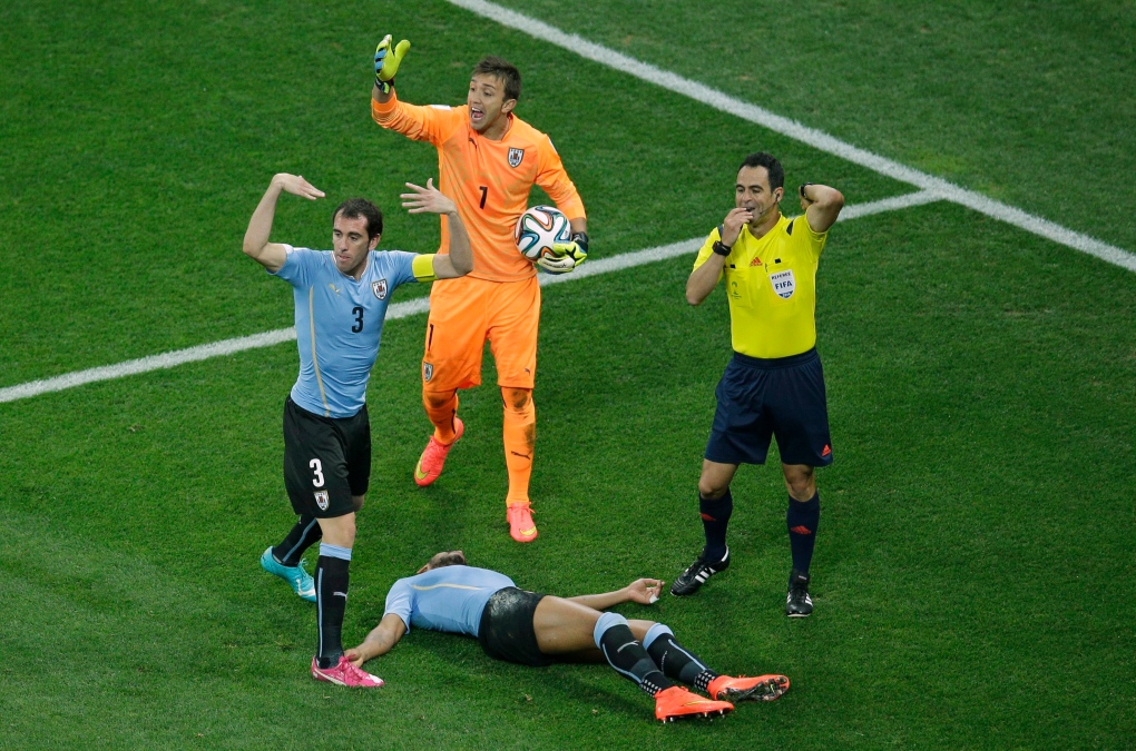 Uruguay's Alvaro Pereira concussion World Cup