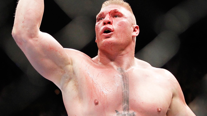 Brock Lesnar celebrates his second round victory over Shane Carwin during their UFC heavyweight mixed martial arts title match Saturday, July 3, 2010, at The MGM Grand Garden Arena in Las Vegas