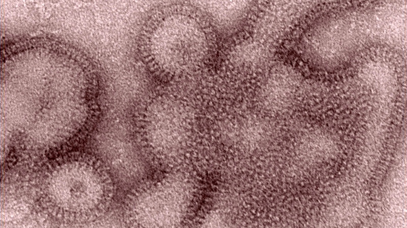 This scanning electron micrograph view depicts some of the ultrastructural details displayed by swine-origin H3N2 influenza viruses responsible for causing illness in Indiana, Maine, Iowa, Pennsylvania and West Virginia in 2011.