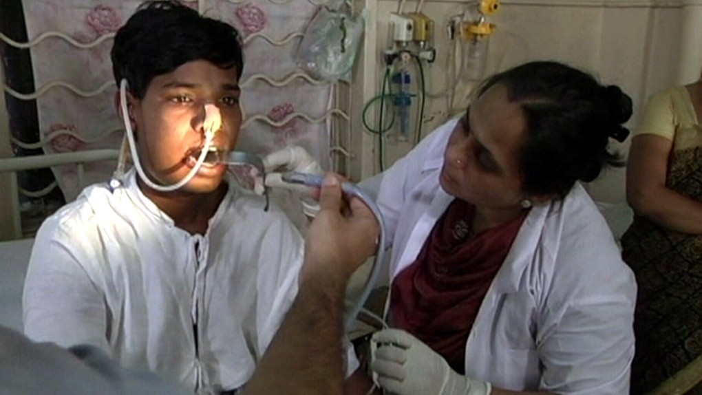 Ashik Gavai suffers complex odontoma