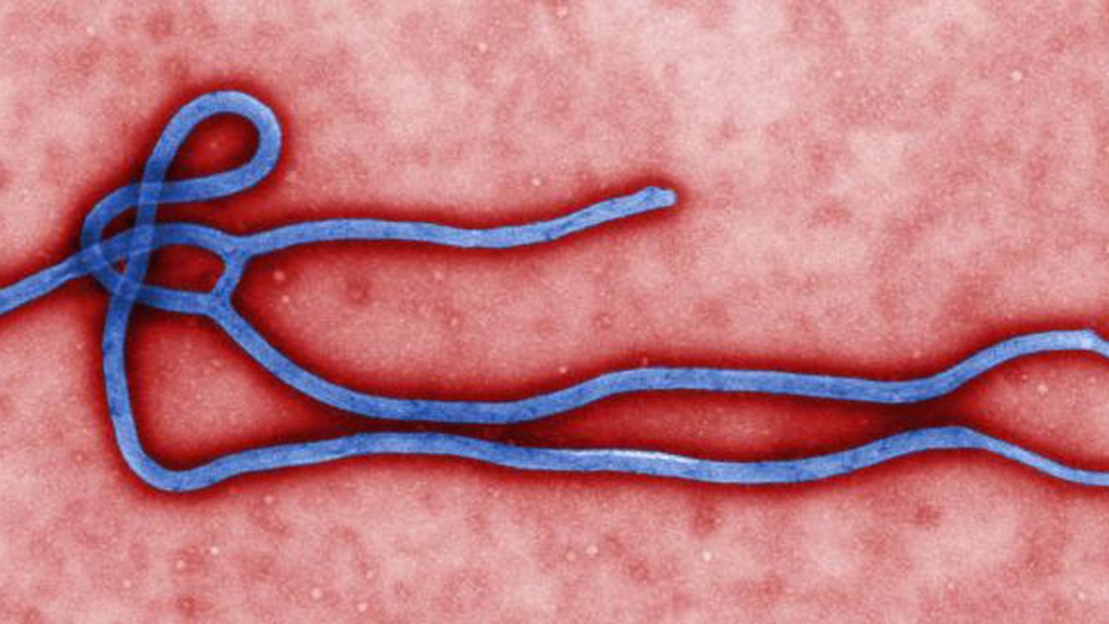 CDC photo of an Ebola Virus