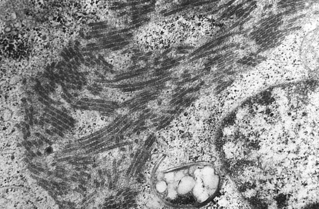 CDC photo of an Ebola Virus 