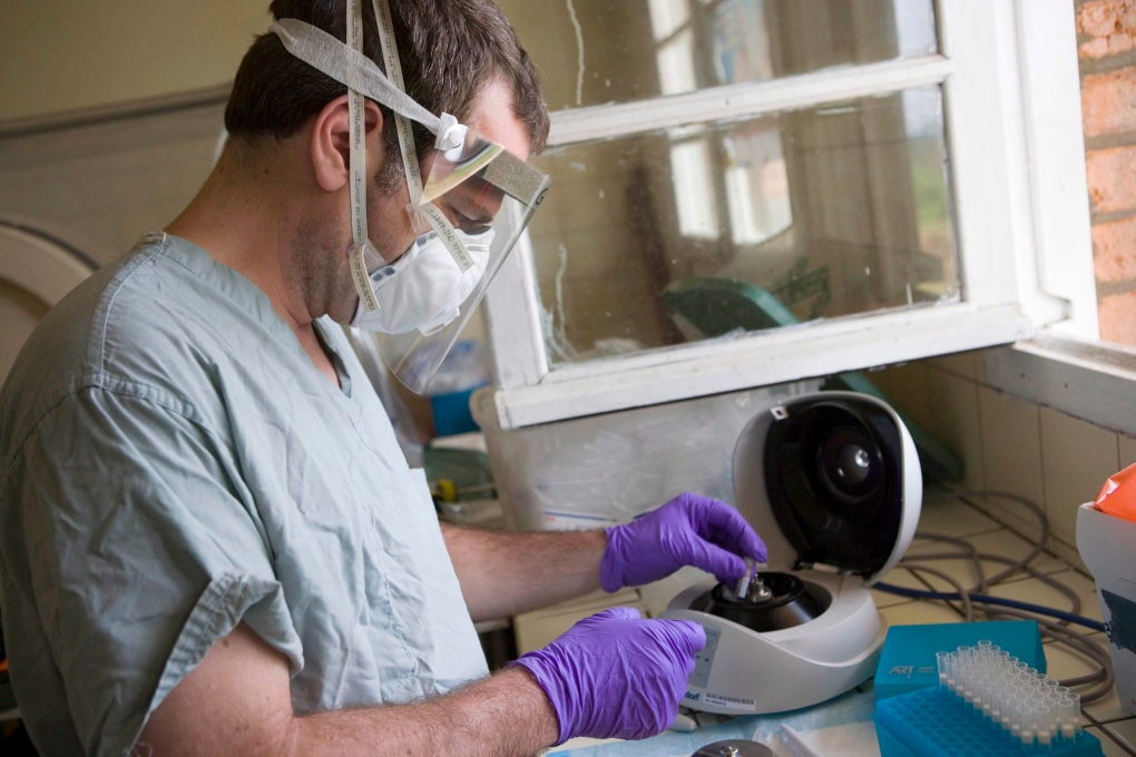 Canadian research at heart of Ebola treatment