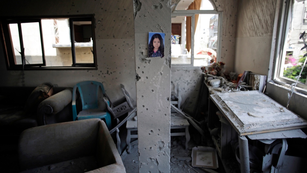 War wounds unhealed in Gaza