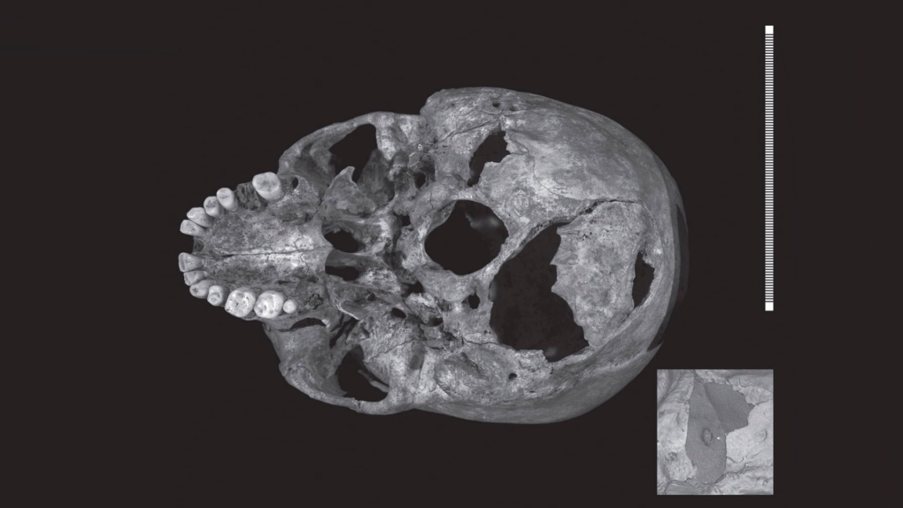 Skull of King Richard III