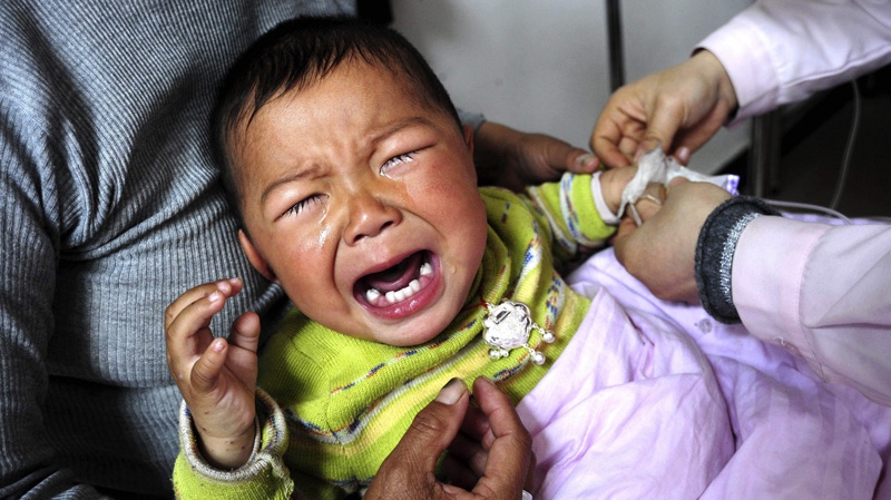 A child suffering from hand, foot and mouth disease gets medical attention at a hospital in Hefei, central China's Anhui province Saturday April 11, 2009. (AP Photo) 