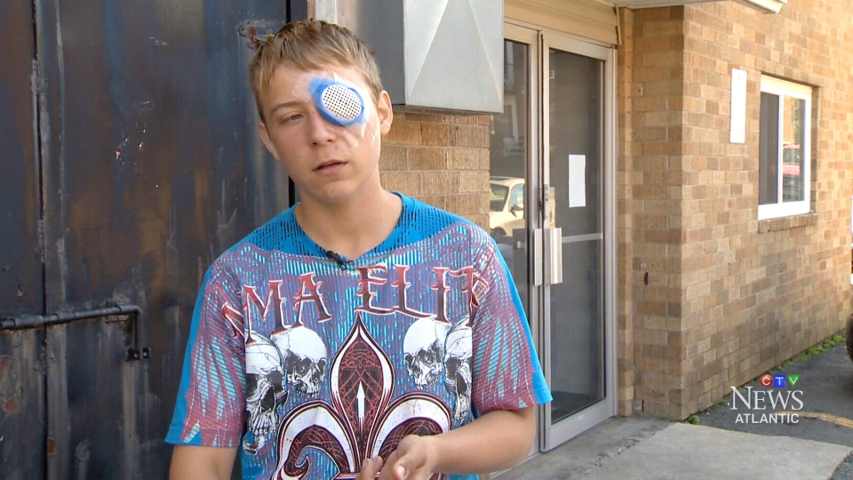 Teen stabbed in the eye by a senior