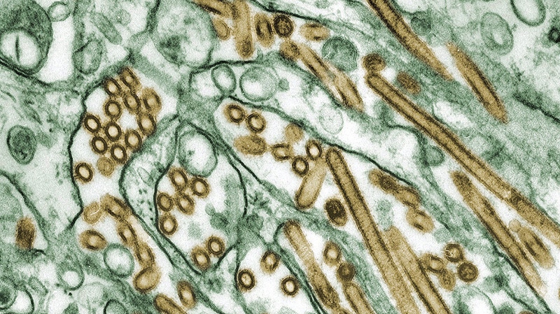 Colorized transmission electron micrograph of Avian influenza A H5N1 viruses