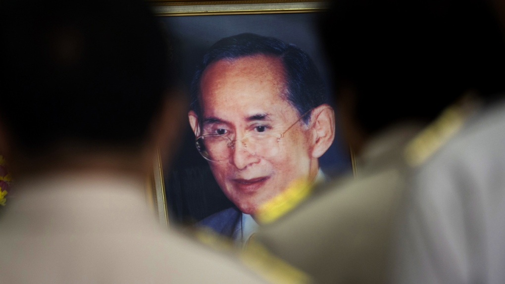King of Thailand undergoes gallbladder surgery