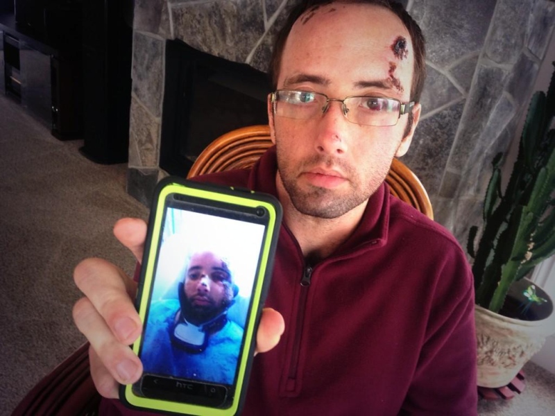 Peter Lossing holds up a photo of his injuries after a crash on Oct. 10, at his home in Amherstburg, Ont. on Tuesday, Oct. 21, 2014. (Sacha Long / CTV Windsor)