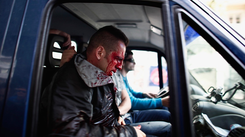 An injured and bleeding policeman is taken away in a police vehicle after he was attacked by protesters in Athens