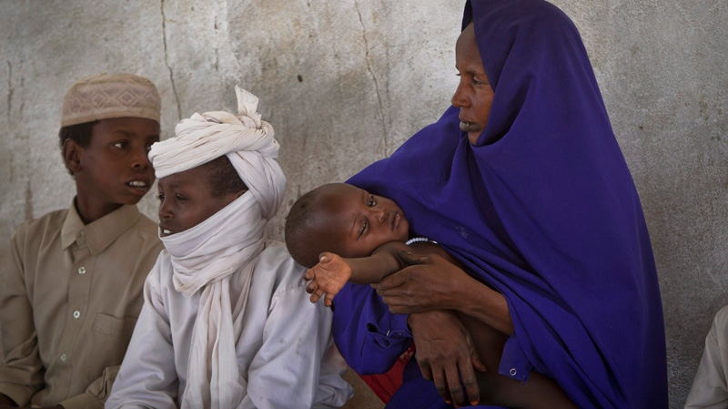 Mother Hadetta Mohammed holds her son Omar Lamine, 2, as she waits for him to be examined for signs of malnutrition at a walk-in nutrition clinic in Barrah, a desert village in the Sahel belt of Chad