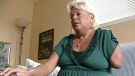 Daniele Rousseau is filing a lawsuit against her osteopath over an arm amputation, Thursday, April 26, 2012. 