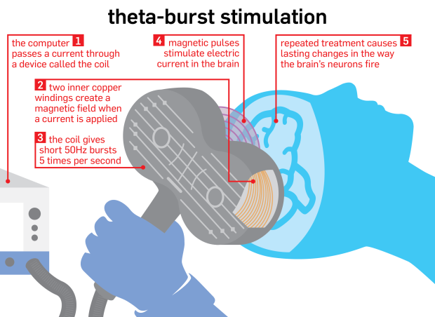 Theta-burst graphic