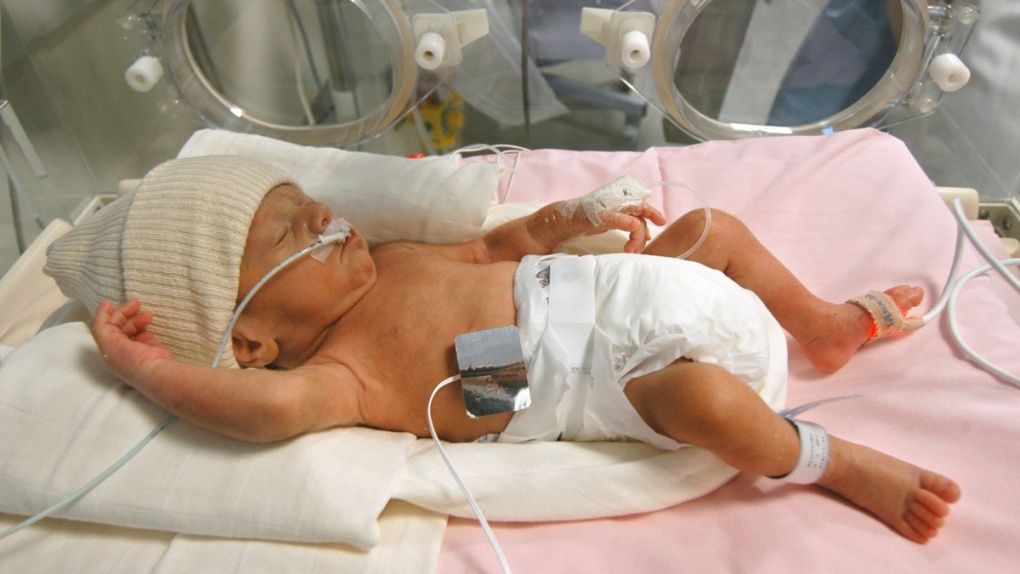 An early premature baby