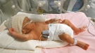 An early premature baby sleeps in an incubator in a hospital in southern France, Tuesday, Jan. 18, 2005. (AP / Claude Paris)