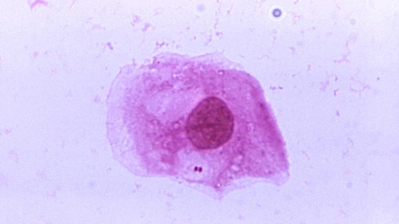 A photomicrograph of Neisseria meningitidis recovered from the urethra of an asymptomatic male. (CDC / James Volk)