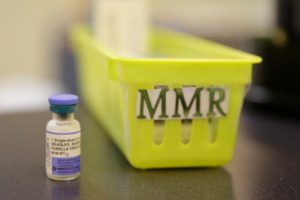 Second measles case confirmed in Niagara Region