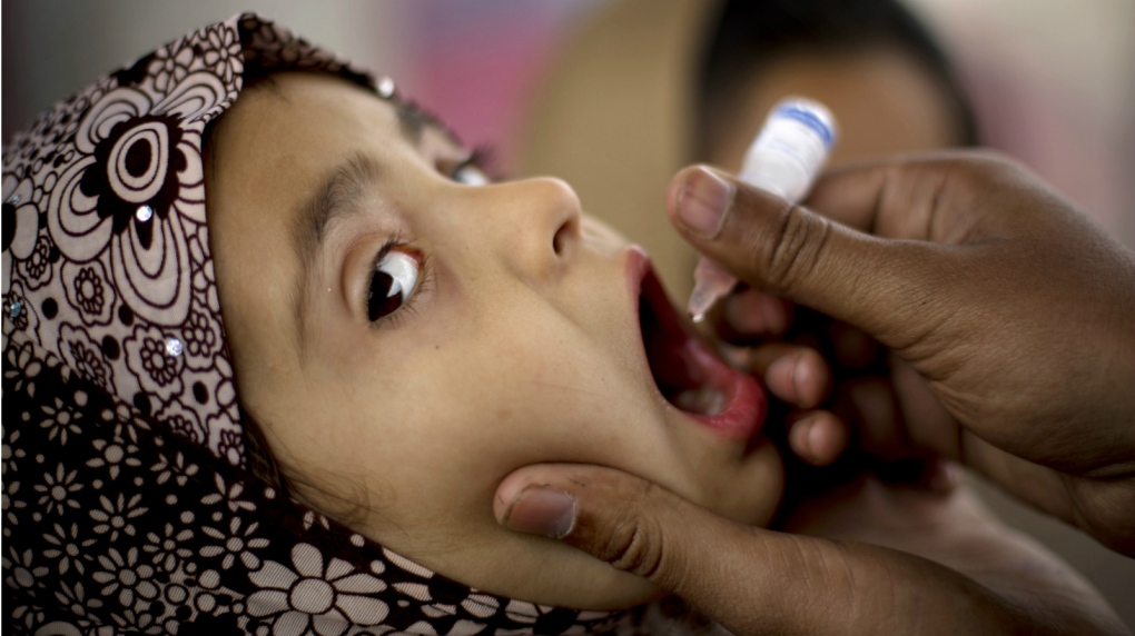 Pakistan in fight to eradicate polio with vaccines