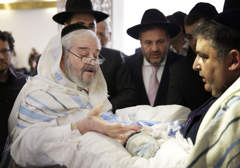 A circumcision is performed in New York 