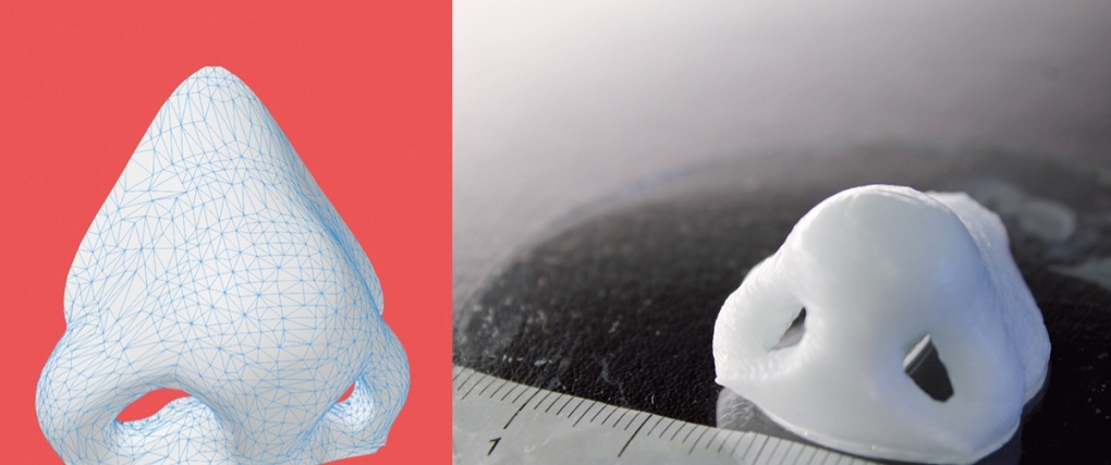 3D printed nose job