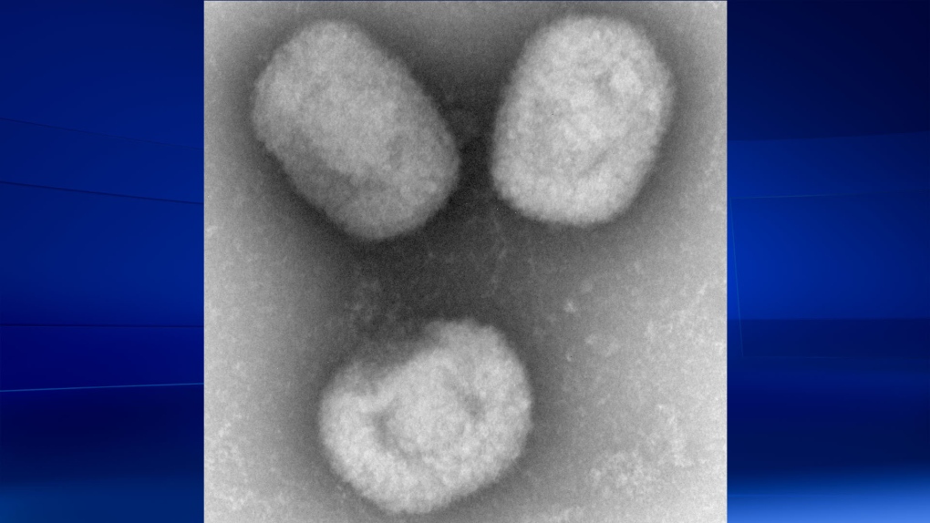 Akhmeta virus