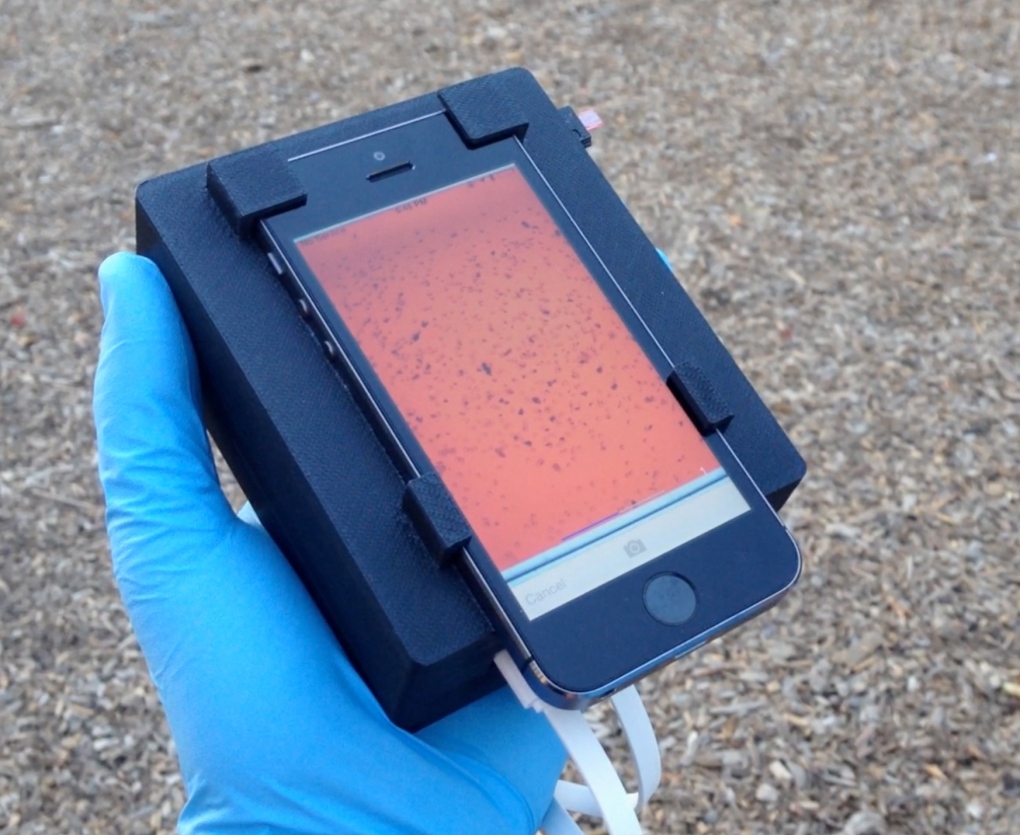 Smartphone can test for blood parasites