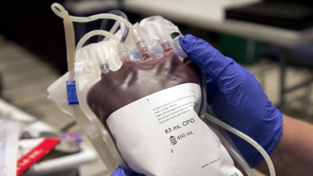 FDA lifts lifetime ban on blood donations from gay men